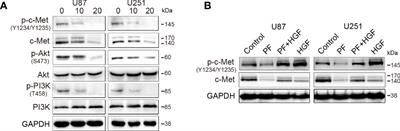 Paeoniflorin Inhibits EMT and Angiogenesis in Human Glioblastoma via K63-Linked C-Met Polyubiquitination-Dependent Autophagic Degradation